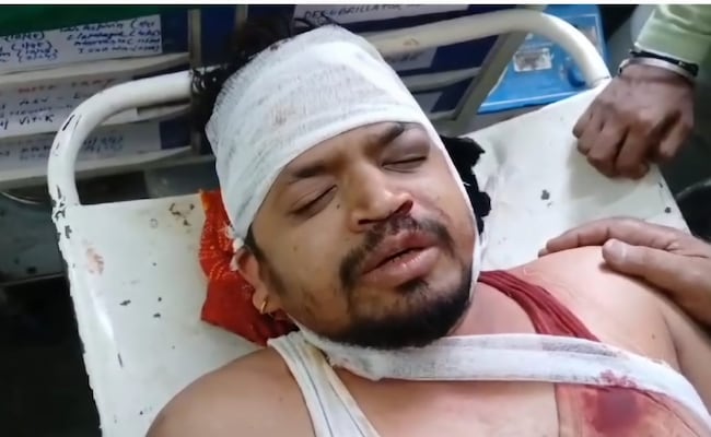 Read more about the article Madhya Pradesh Professor Attacked With Sticks, Chilli Powder After Argument With Student