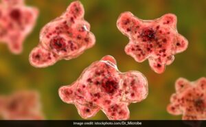 Read more about the article Brain-Eating Amoeba Kills Israeli Man, 25, After He Went Swimming On Beach