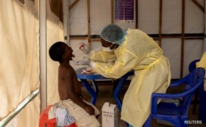 Read more about the article Mpox Declared Public Health Emergency By Africa After Massive Outbreak