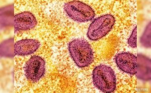 Read more about the article Africa Reports 1,100 Mpox Deaths, Warns Outbreak Is “Out Of Control”