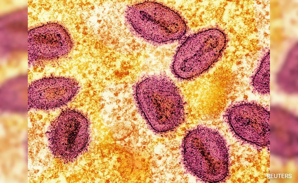 Africa Reports 1,100 Mpox Deaths, Warns Outbreak Is "Out Of Control"