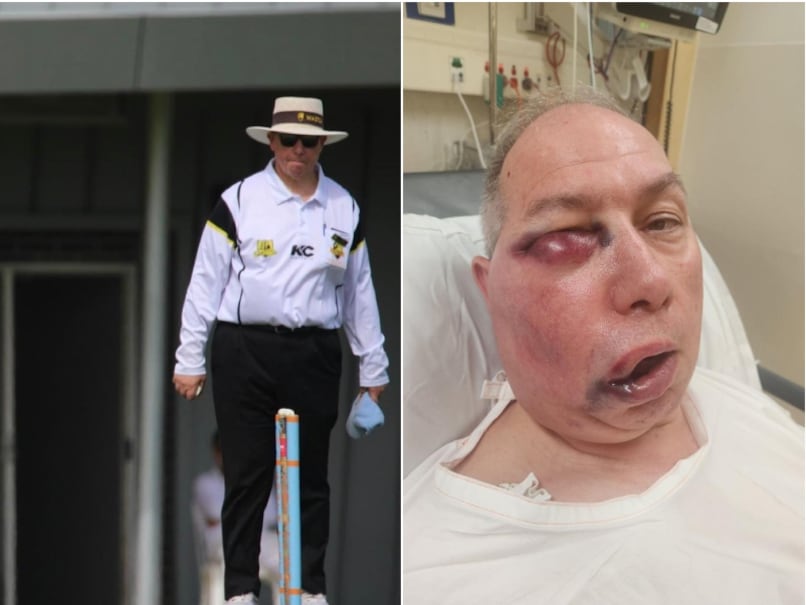 Read more about the article Australian Umpire Under Observation After Suffering Facial Injury While Officiating