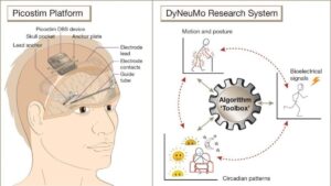 Read more about the article UK boy fitted with world’s first epilepsy device. Why this could be a game changer – Firstpost