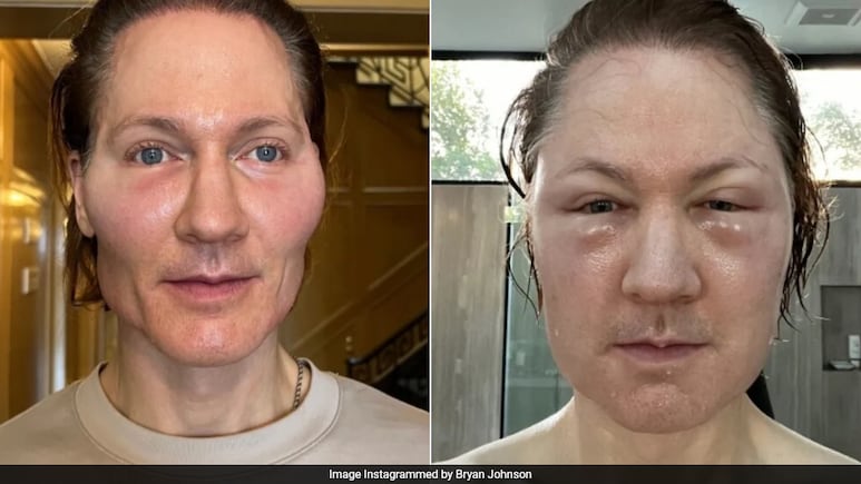 Bryan Johnson, Tech Millionaire Whose Anti-Ageing Experiment Went Wrong