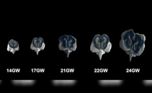 Read more about the article IIT Madras Captures Images Of Fetal Brain, World’s Most Detailed Yet