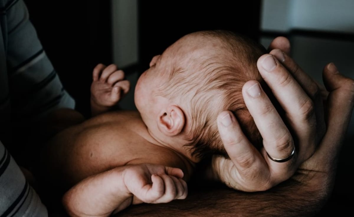 Read more about the article Babies In Spain Develop ‘Werewolf Syndrome’ After Parents Use Hair-Loss Drug: Report