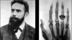 Read more about the article How a German scientist accidentally discovered X-rays and changed the world – Firstpost