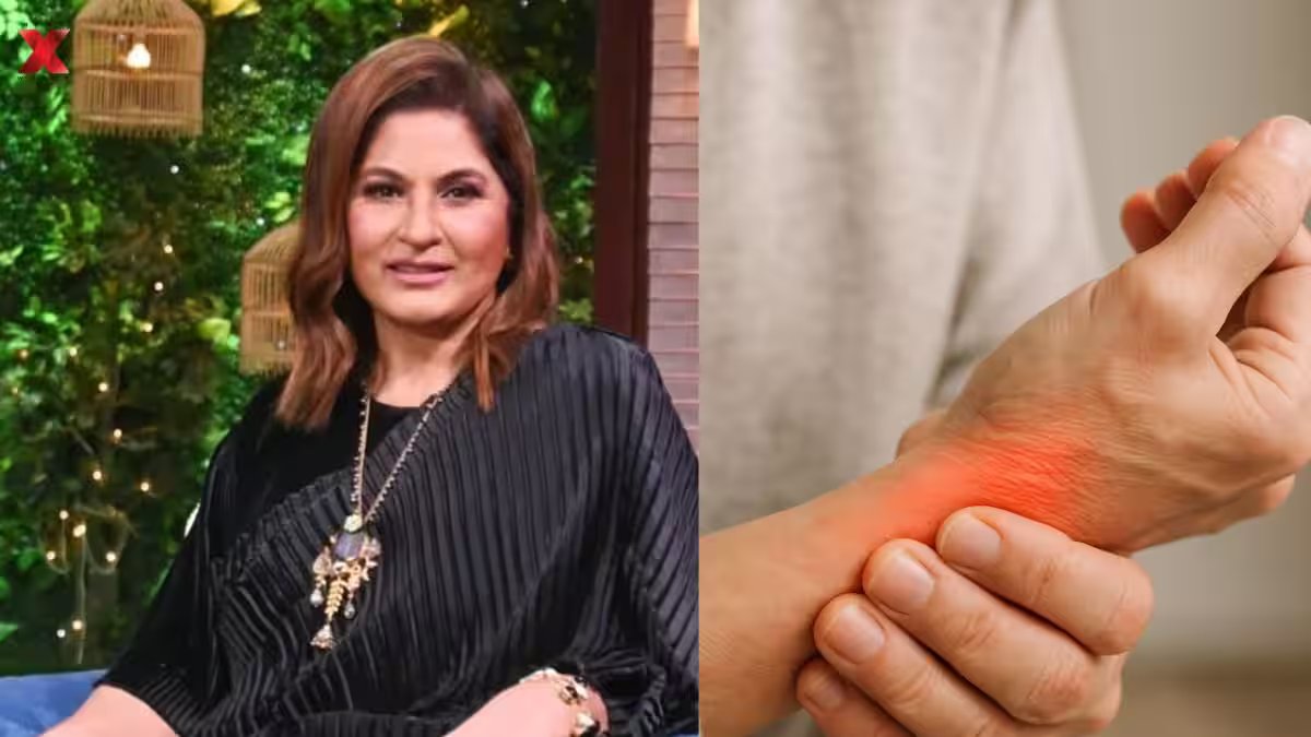 Netflix's 'The Great Indian Kapil Show' judge and actress Archana Puran Singh suffering from Complex Regional Pain Syndrome; here's what the disorder means