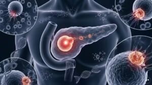 Read more about the article Why younger, non-diabetics are being diagnosed with pancreatic cancer – Firstpost